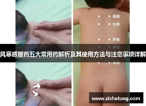 风寒感冒药五大常用药解析及其使用方法与注意事项详解